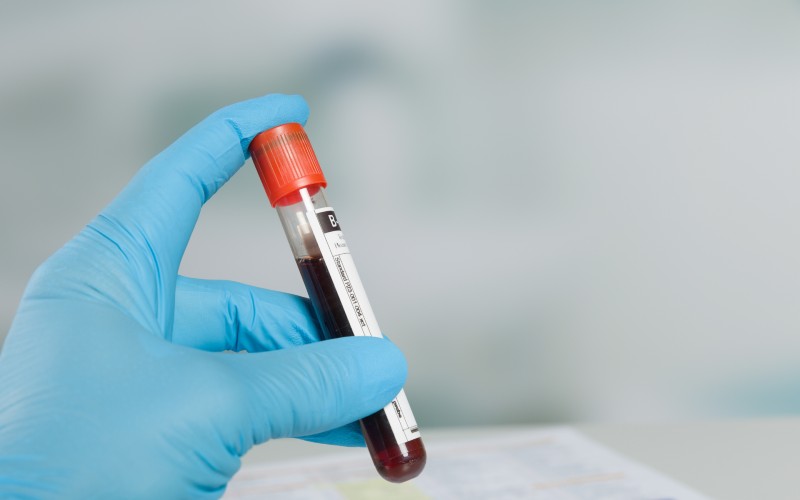 A Landmark Moment: Update on the UK’s Infected Blood Compensation Scheme